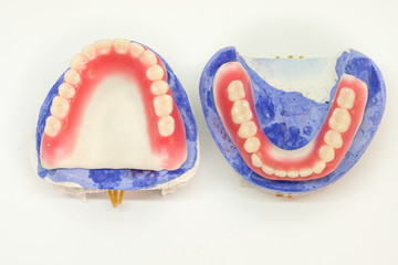 artificial teeth arrangement in complete denture