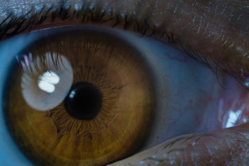 Eye