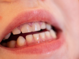 Obraz premium Red lips, even white teeth and pink tongue. Baby finger in mouth. A boy of 3 years. Macro close up