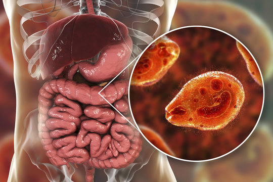 Balantidium coli protozoan in large intestine, 3D illustration. Ciliated intestinal parasite that causes balantidiasis