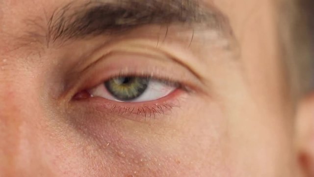 man wipes his tired left eye with his fingers and looks at something intently, closeup macro
