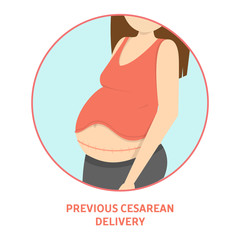 Medical reasons for cesarean delivery or c-section