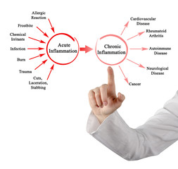 Acute and Chronic  Inflammation
