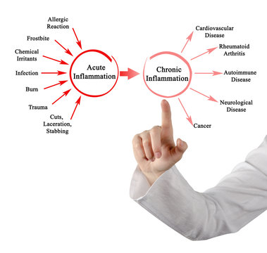 Acute And Chronic  Inflammation