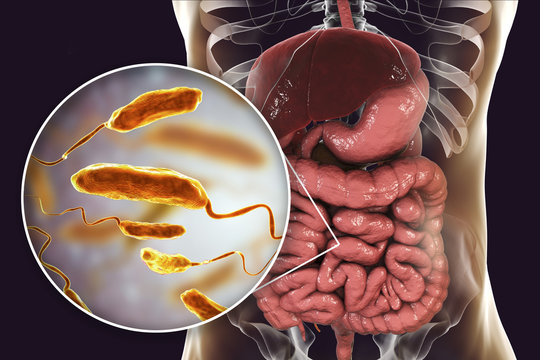 Vibrio cholerae bacteria in small intestine, 3D illustration. Bacterium which causes cholera disease and is transmitted by contaminated water