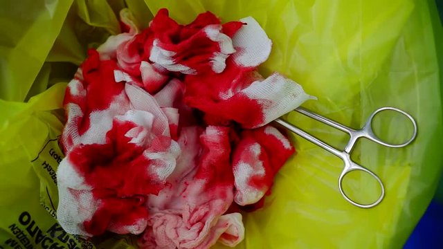 blood-soaked bandages and tongs are lying in garbage bin in operating room during operation