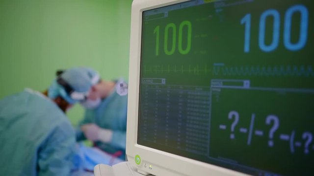 vital signs on a monitor of modern medical equipment during operation in a clinic, surgeons