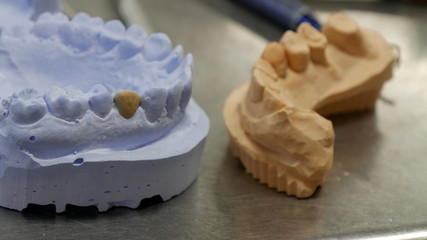 Laboratorio odontoiatrico calco dentiera