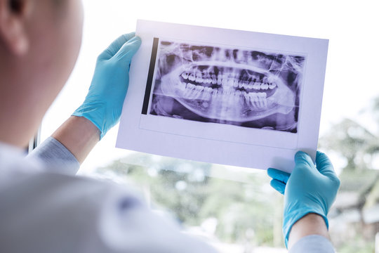 Image of male doctor or dentist holding and looking at dental x-ray
