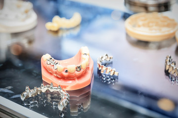 various samples of casts of dentures, close up