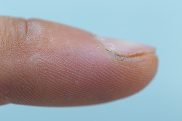 human finger, macro