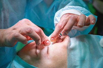 Surgeon and his assistant performing cosmetic surgery on nose in hospital operating room. Nose...