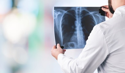 Young man doctor holding x-ray