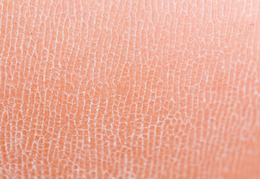 Background of human skin macro