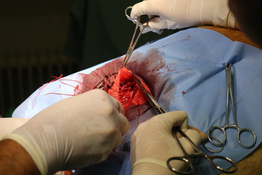 Surgical intervention by perineal hernia by dog (hernia involving the perineum)