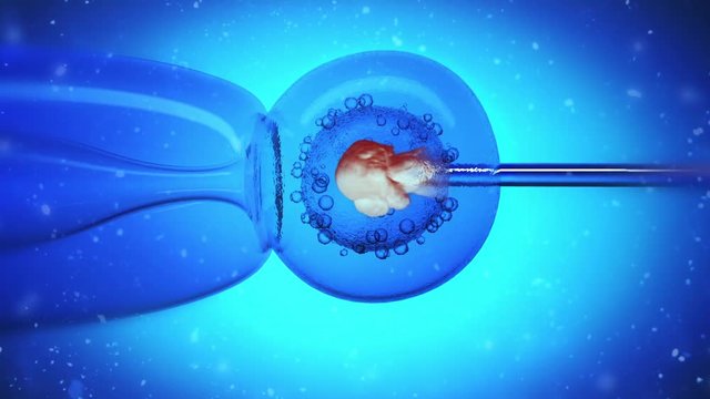 Collection and re-injection of stem cells