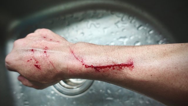 Scratch and Blood on arm after a man try to catch a domestic cat on the road, man's  arm placed on a board with a long slice/cut/wound going across it with blood on it drying up, Healthcare conceptual