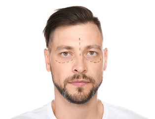 Portrait of mature man with marks on face preparing for cosmetic surgery against white background