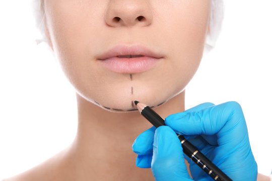 Doctor marking young woman face before cosmetic surgery on white background, closeup