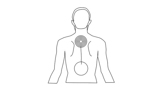 Animated sketch vector drawing doodle pain points radiating from male spine back drawn in black changes to color illustration
