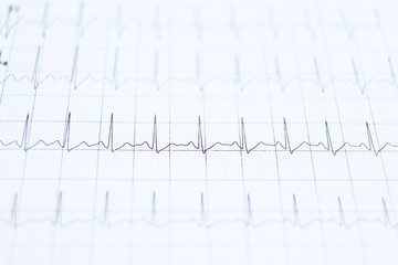 cardiogram background