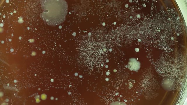 growth of bacteria taken in a supermarket in a Petri dish time lapse