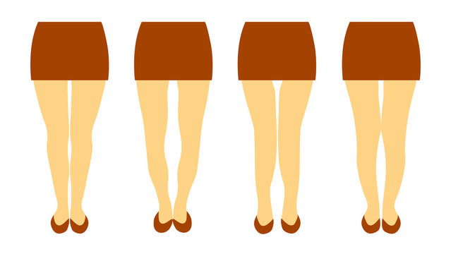 Vector illustration with different shapes of women legs