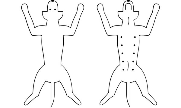 Ventral/Dorsal Dog View