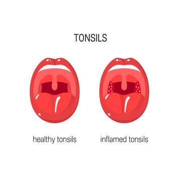 Tonsils vector illustration