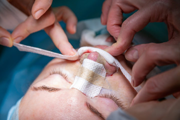 Surgeon and his assistant performing cosmetic surgery on nose in hospital operating room. Nose reshaping, augmentation. Rhinoplasty.