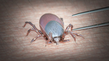 3d rendered illustration of a tick being removed