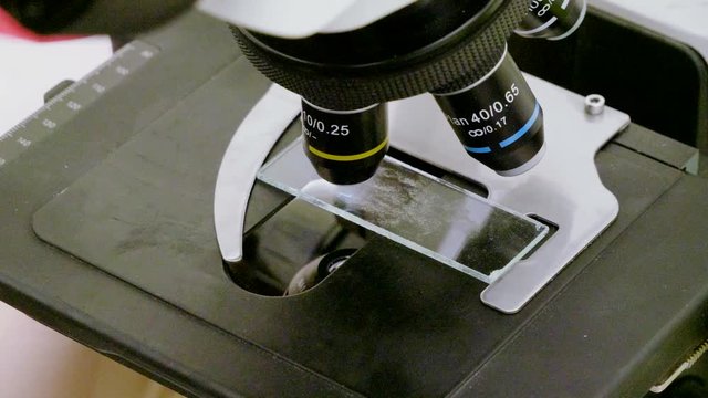 Veterinarian looking at biological sample from dog's ear under microscope in veterinary clinic. 4K