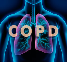 Motiv COPD - Lunge und Bronchien