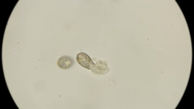 infusoria Coleps, class Ciliata, tear apart organic remains of a dead infusoria, scavengers of the micro world, under a microscope