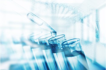 Glass laboratory flasks on light table