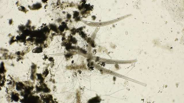 Infusorium Spirostomum with an elongated body capable of strongly bending, under a microscope