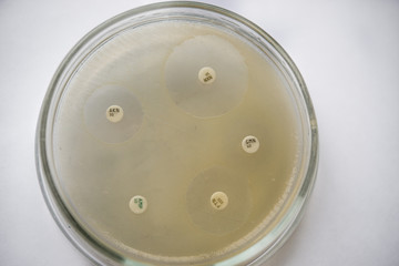 Petri dish with antibiotics