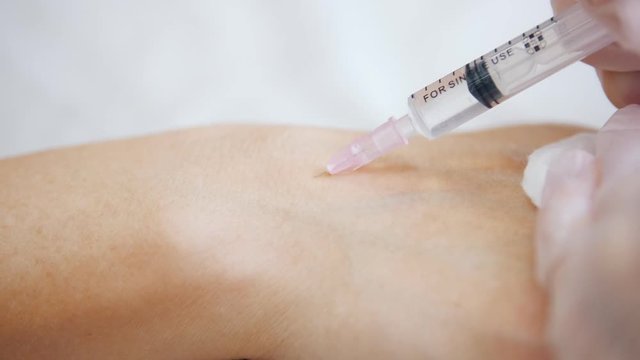 Cosmetology clinic. Specialist is injecting fillers in client arm. Close up