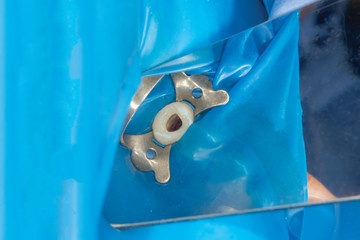 two chewing side teeth of the upper jaw after treatment of caries. Restoration of the chewing surface with a photopolymer filling material using the Rubber Dam system © Сергей Кучугурный