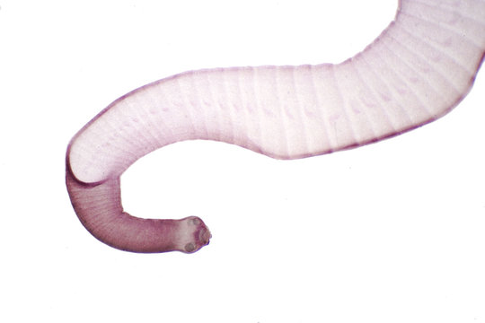 Tapeworm (Parasitic flatworm) of cattle and other grazing animals