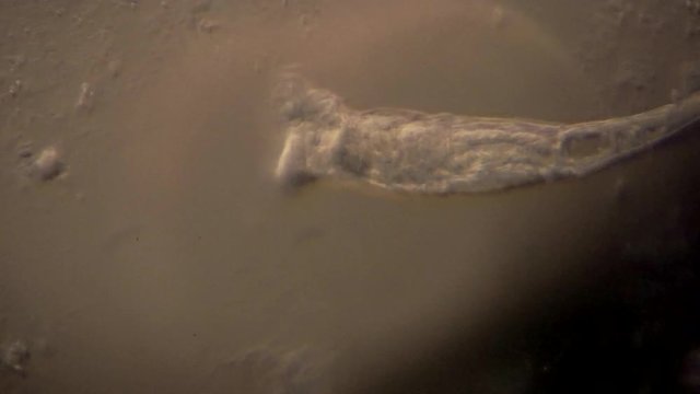 Microscopic rotifers feed and move about.