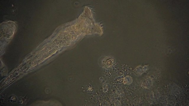 Microscopic Rotifera use cilia to filter feed, as seen through a phase contrast microscope.  The movement of their cilia gives the appearance of rotary movement.