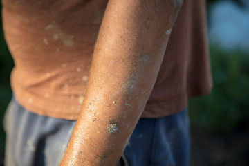 Dirty hands of a worker at a construction site
