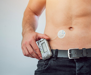 Diabetic man with an insulin pump connected in his abdomen and keeping the insulin pump on his belt. - obrazy, fototapety, plakaty