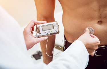 Doctor with an insulin pump connected in patient abdomen and holding the insulin pump at his hands.
