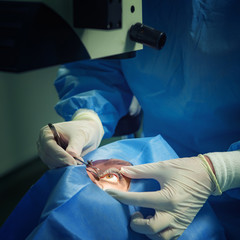 Operating room. Eye surgery