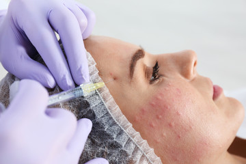 Woman undergoing face biorevitalization procedure in salon, closeup. Cosmetic treatment