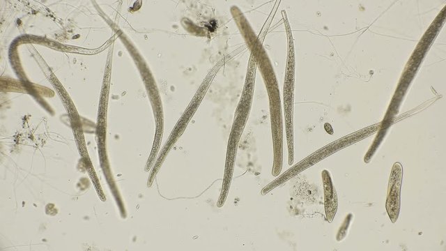 Colony Infusorium Spirostomum with an elongated body, capable of strongly bending, and other types of ciliates under a microscope