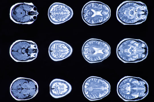 X-ray image of the brain computed tomography, imaging of the brain.
