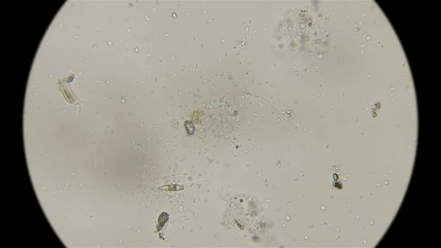 a drop of dirty water with a lot of bacteria and microorganisms, under a microscope
